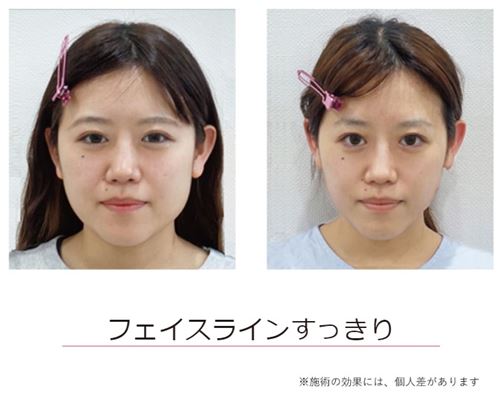 出典:公式サイトより